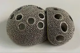 湖北首个3D打印定制式医疗器械完成备案，骨骼假体将实现“量身定制”图片