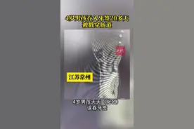 4岁男孩误吞牙签，喊疼20多天家长才带去医院图片