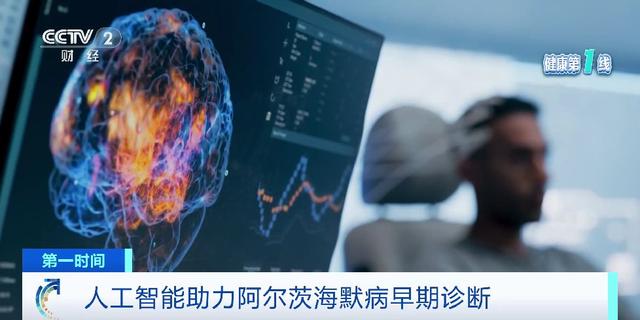 全球人口老龄化推高阿尔茨海默病患病率，AI可助力早期诊断