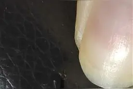 网友租用共享电车被车座上的针扎伤？律师提醒：第一时间报警图片