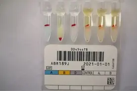 最新发现：小p血型！图片