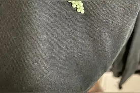 头皮发麻！最近很多广东人衣服上有虫卵图片