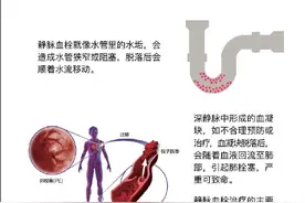 沉默的杀手——静脉血栓栓塞症图片