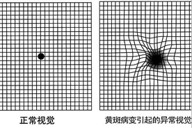 长宁这家医院开设“低视力康复与眼底病门诊”，这些患者重获“视”界图片