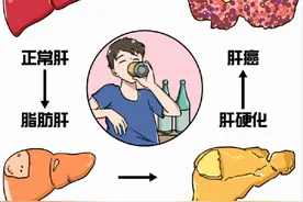 女子每天只吃黄瓜苹果半年减重20公斤，体检发现重度脂肪肝图片