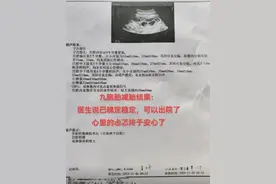怀9胞胎女子丈夫欲追责医院：减胎花费4万多元！图片