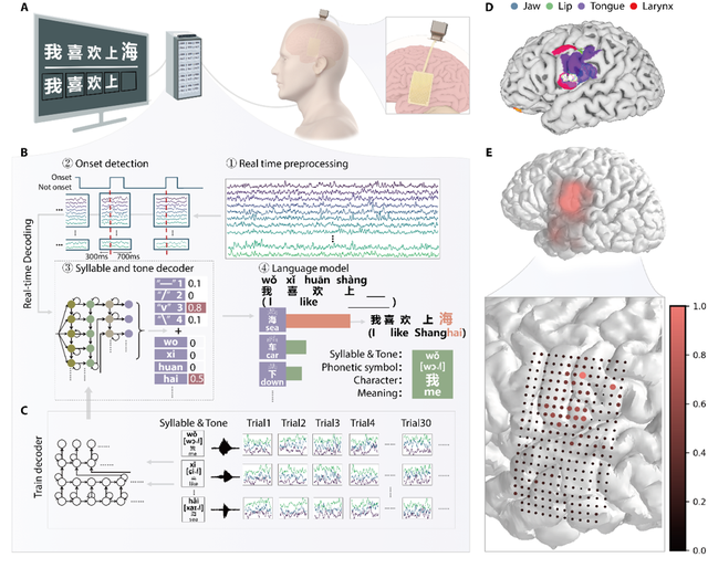 上海脑机接口里程碑突破受业界关注！脑虎科技：加速临床转化，惠及患者