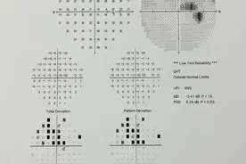 男子一觉睡醒几乎“瞎”了！一查竟是“眼中风”图片