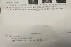 杭州27岁女子摔跤后被确诊腰椎间盘突出症……妈妈崩溃，医生：这习惯很多人都有！图片