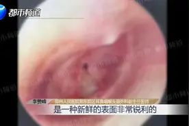 新婚夫妻亲吻太激动，耳膜爆裂性穿孔！医生提醒→图片