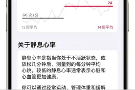 和心脏对话 Apple Watch也许是一个巧妙的桥梁图片