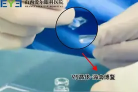 健康中国看山西：山西爱尔眼科医院副院长陈鹏在海南博鳌成功实施特许手术项目——EVO+Visian ICL（V5）晶体植入图片