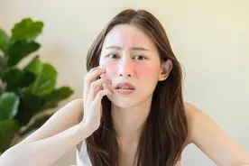 潮健康福利馆丨春节后遭遇“皮肤劫”，如何补救？打工人必看！图片