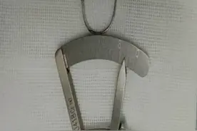 铁钉射进5旬男子左眼，医院连夜手术巧取“眼中钉”图片