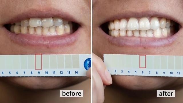 咖啡是白天喝的，牙是夜里变黄的