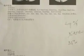 痛心！九胞胎一个都没保住 丈夫最新发声图片