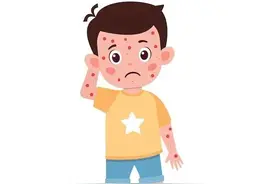 麻疹预防小知识，请查收图片