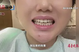 壹点帮办|牙冠修复遇问题，青岛一市民质疑口腔机构治疗不规范图片
