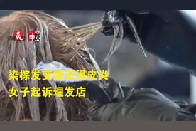 染发翻车，棕色变绿还得了皮炎，女子气得起诉理发店图片