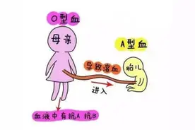 ABO溶血并非是谈虎色变的疾病图片