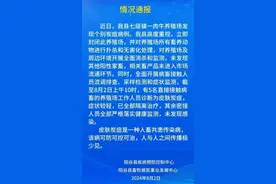 山东阳谷县发现炭疽病例，当地称平稳可控 专家：要注意疫源地彻底消毒，人传人风险极低图片