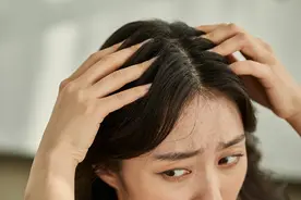 一天不洗头，头发就“冒油”！为什么你的头发比别人更容易油？图片