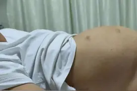 “肚子大”以为是胖，一查竟是瘤！肚子出现这些异常要重视→图片