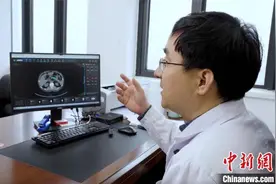 浙江宁波医院引入达摩院医疗AI 已发现6例早期胰腺癌图片