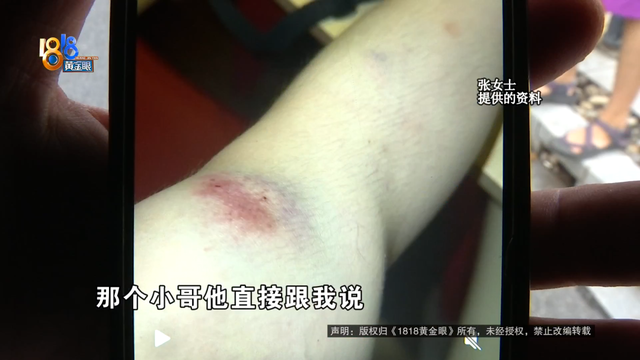 女子骑车被外卖小哥撞伤，本想私了要求赔三百医药费，外卖小哥：我只有三块钱