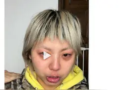 张大大疑似殴打同事，所属MCN公司无忧传媒：暂停与他的一切业务开展，彻查此事图片