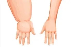 “乳腺健康”系列图片