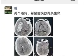 “两个通宵，救两条命！”浙江海宁神经外科医生日常：连轴转！经常凌晨还在手术台上…图片