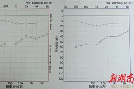 听力下降5年也可恢复正常 男子“耳硬化症”术后重获新“声”图片