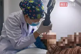 小伙“战痘”6年留下重度痤疮瘢痕，医生用点阵激光联合自体脂肪移植为其“填平”痘坑图片