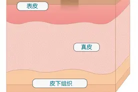 被蚊子叮了为什么会留下黑印？这些方法能去除→图片