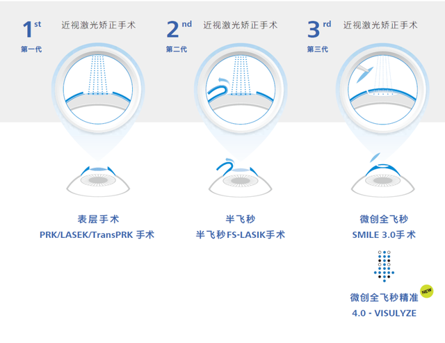 南京华厦眼科医院院长鲍连云解读微创全飞秒精准4.0新突破