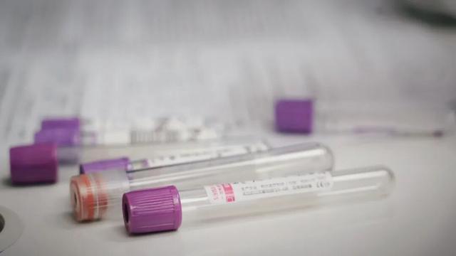 十年间一个指标导致的死亡大幅增加，很多人体检超标却不知道