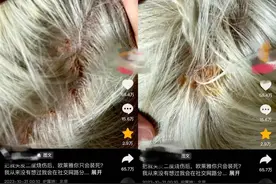 花5000块去旗舰店染发，竟致二度烧伤！“发型师神奇消失”图片