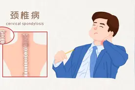 四种类型颈椎病，哪一种最不好惹 | 科普时间图片