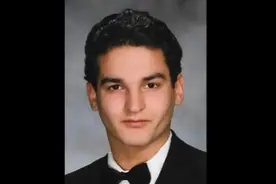 全球首例成功换脸换手男子，下月结婚图片