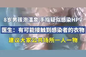 8岁男孩泡温泉，手指疑似感染HPV！做到以下5点，安心游泳泡温泉图片