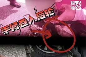 上海7岁女孩手臂卷入车轮，惨遭“扭麻花”致骨折！起因太意外……这行为或许你也有！图片