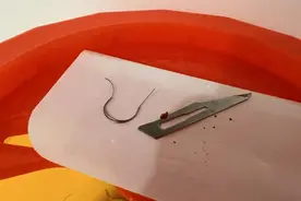 蜱虫叮咬高发季到，严重时可致人死亡！医生：这几步处理很重要图片