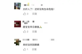 突然爆炸！男童全脸30多处伤，只因家里这个“玩具”图片