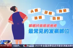国际带状疱疹关注周丨蛇年，警惕“蛇缠腰”图片