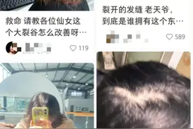 发缝越来越宽，怎么办？这种情况要赶紧治疗图片