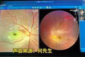 “95后”女子一觉醒来右眼失明！医生：已错过最佳抢救时机图片