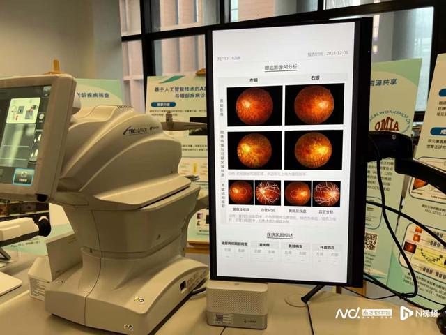 “琶洲之星”专访：科研人员用AI大幅提升青光眼筛查效率