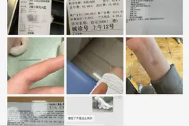 太崩溃！杭州姑娘被它折磨一年！冬季高发，有人20年了都治不好图片