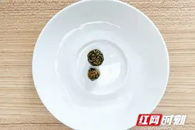 女子腹胀腹痛一直当成胃病治 症状加剧就医才知真凶是结石图片